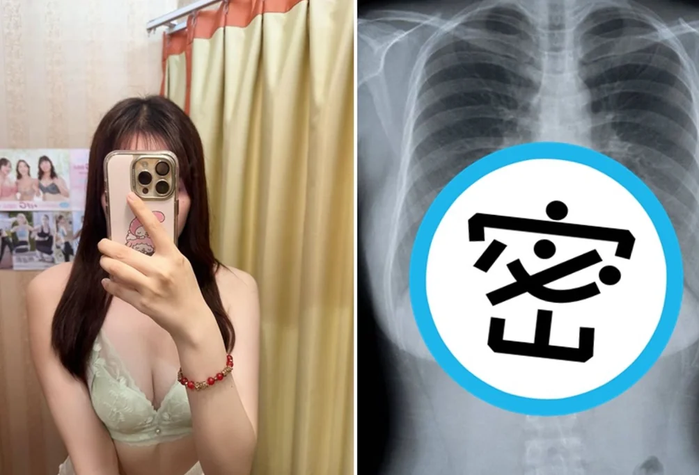 震撼！女子公開乳房X光高清圖　125萬人搶看：比裸照還刺激