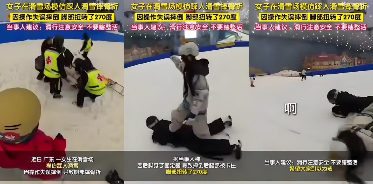 滑雪場男生當“人肉滑雪板”！女生狂踩喊爽結果小腿270度骨折