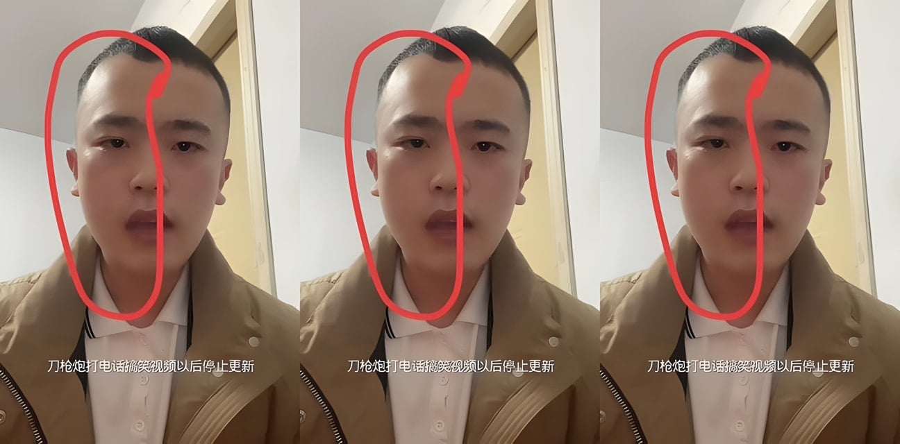 崔玉彬給臨沂刀槍炮打電話！臉腫連夜清空視頻道歉