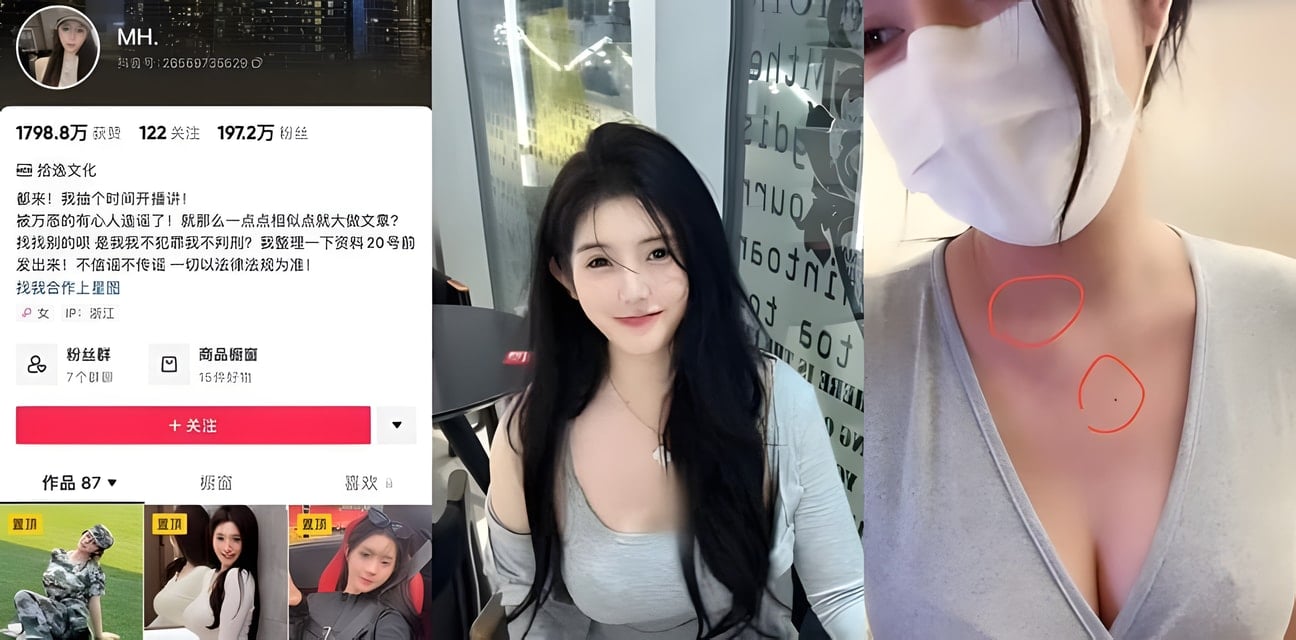 抖音百万网红MH走红前黄播实锤！胸口痣吻合本人